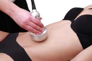 Read more about the article What Is Ultrasonic Cavitation and How Does It Work?