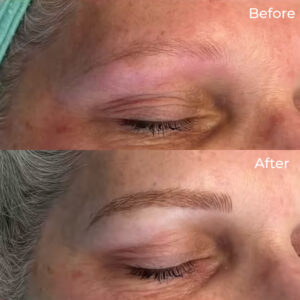 microblading before & after